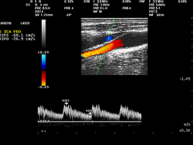 carotid_ultrasound_image_tests